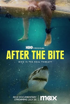 After the Bite izle